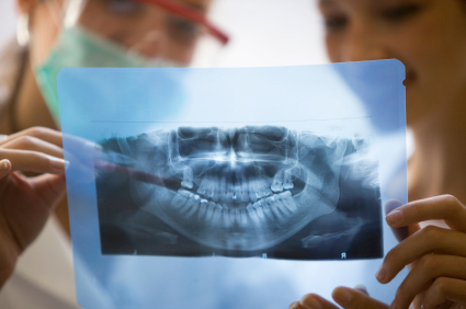 Сроки протезирования зубов в МЦ ИХИЛОВ